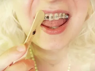 ASMR Mukbang with Braces: Intense Sounds