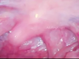 Uvula Dancing Oral, Throat Vibrations BTS