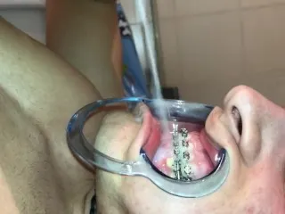 Braces Brutal Cumshot