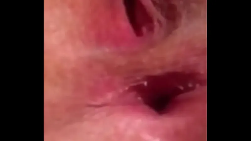 Anal Play with Pinworm Intense Scene