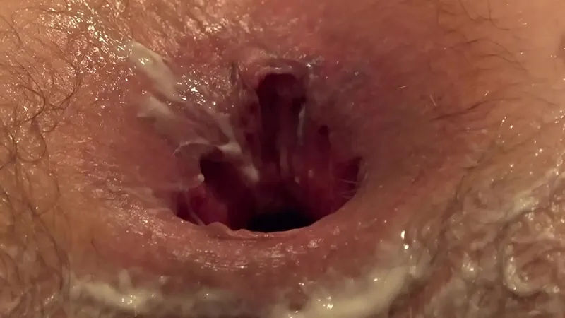 Lesbians: Hardcore Anal Fisting, Gaping Butts, Cunnilingus