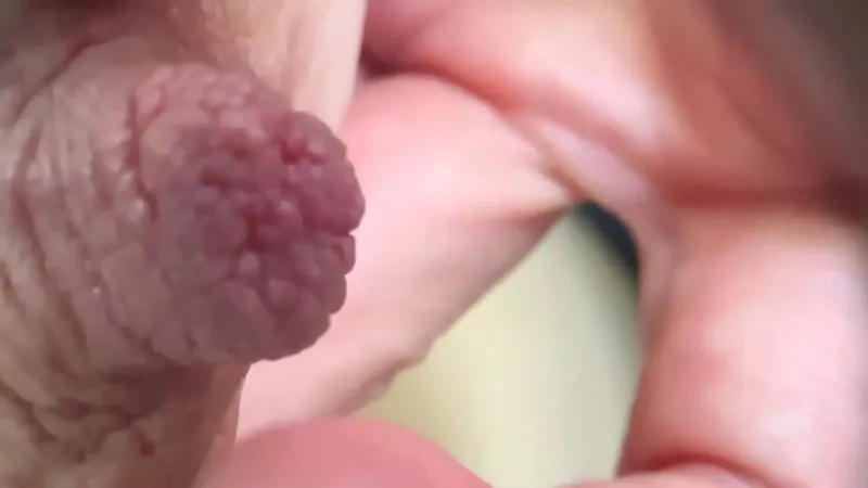 Extreme Nipple Play - Unseen Extremes