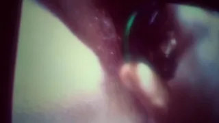 Gross fat pussy