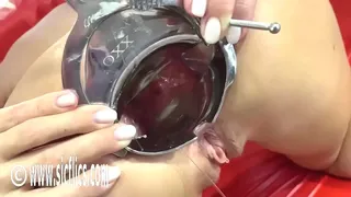 Slut Wife Fist Fucked in Her Loose Speculum Stretched Ass