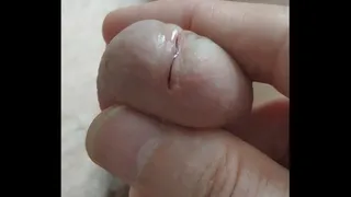 Spontaneous erection, semen, precum