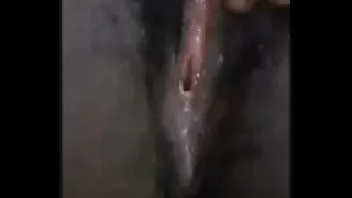 Horny medical student