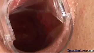 Speculum beauty masturbating before spreading lips