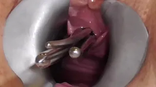 Amateur FreyjaAnalslut:  rods in Freyja's pisshole