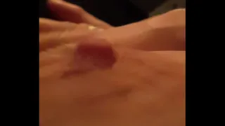Painful nipple