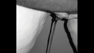 Lot of pee