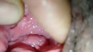Stick a finger in the Thai girl's clitoris. Her pussy is very beautiful and lickable. Her pussy is white and her clit is smooth.