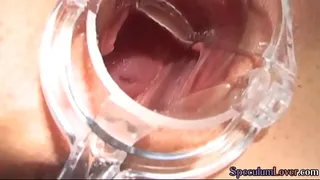 Bigtit speculum beauty in bikini pussy rubbed in duo