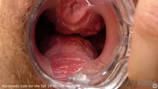 kinky gyno doctor play