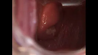 Avy Open Pussy with Speculum