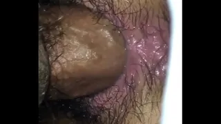 asshole vaginal