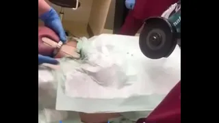 This is how they took the nut out of his cock, the woman is very brave