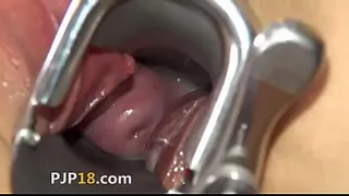 Camera deeply in her gaped vagina vagina