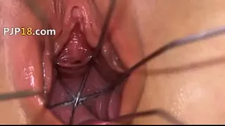 Gyno gaping of beautiful danish model