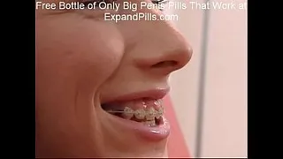 Sandra Skinny Teen Braces Anal Facial