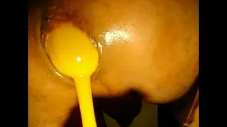 100 2887.MOV rich dilation of my anus