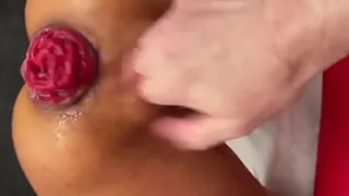 Hard Fisting And Prolapse From A Hot Bitch Monika Fox On Valentine's Day