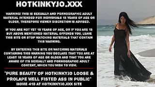 Pure beauty of Hotkinkyjo loose & prolapse well fisted ass in public