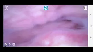 the pussy inside, the clitoris