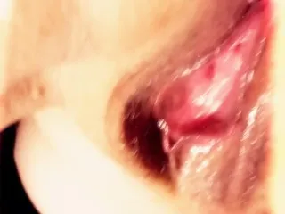 Exposed & Raw